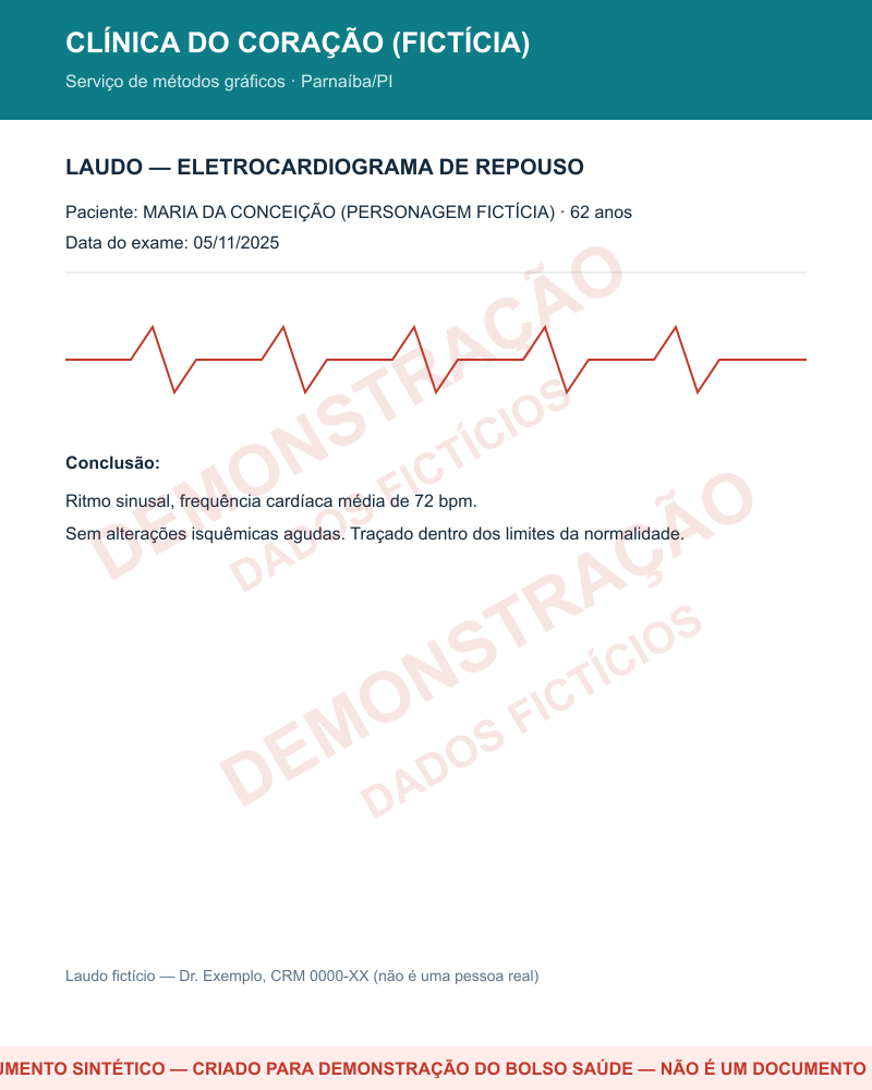 Laudo de eletrocardiograma sintético